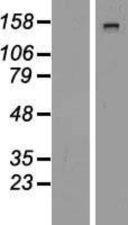 Novus Biologicals&trade;&nbsp;Dystrophin Overexpression Lysate