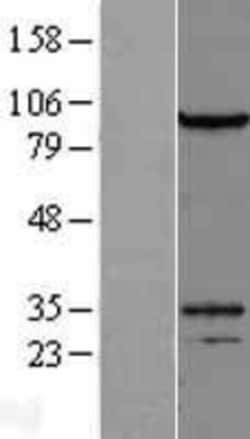 Novus Biologicals&trade;&nbsp;DZIP1L Overexpression Lysate