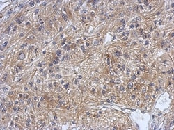 DZIP3 Antibody, Novus Biologicals 0.1mL; Unlabeled:Antibodies, Polyclonal