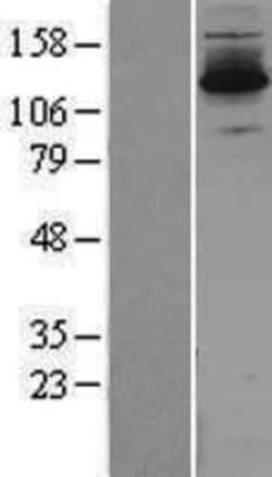 Novus Biologicals&trade;&nbsp;DZIP3 Overexpression Lysate