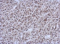 E2F-1 Antibody (16G7), Novus Biologicals 0.1mg; Unlabeled:Antibodies, Monoclonal