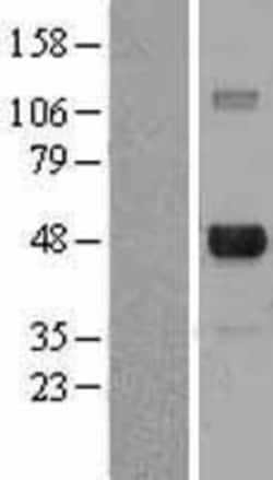 Novus Biologicals&trade;&nbsp;E2F-4 Overexpression Lysate