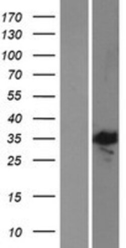 Novus Biologicals&trade;&nbsp;E2F5 Overexpression Lysate
