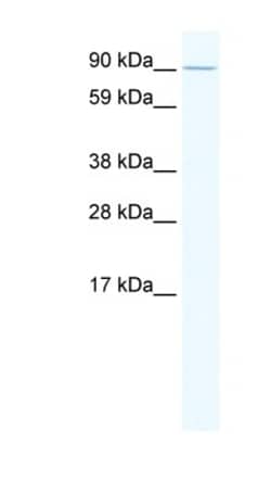 E2F7 Antibody, Novus Biologicals 0.1mg; Unlabeled:Antibodies, Polyclonal