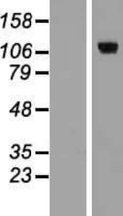 Novus Biologicals&trade;&nbsp;E2F8 Overexpression Lysate
