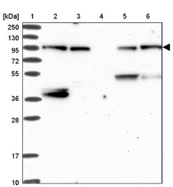 E6AP/UBE3A Antibody, Novus Biologicals 0.1mL; Unlabeled:Antibodies, Polyclonal