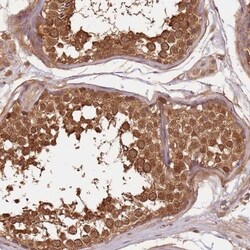 E6AP/UBE3A Antibody, Novus Biologicals 0.1mL; Unlabeled:Antibodies, Polyclonal