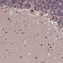 E6AP/UBE3A Antibody, Novus Biologicals:Antibodies:Primary Antibodies