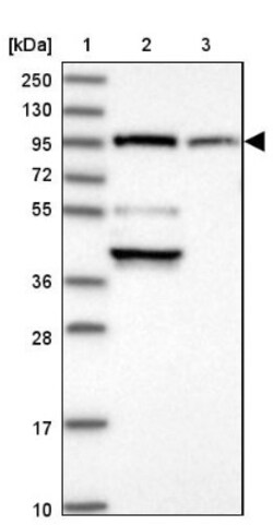 E6AP/UBE3A Antibody, Novus Biologicals:Antibodies:Primary Antibodies