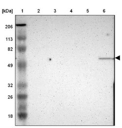 E74 like factor 1 Antibody, Novus Biologicals 0.1mL; Unlabeled:Antibodies,