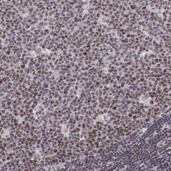 E74 like factor 1 Antibody, Novus Biologicals 0.1mL; Unlabeled:Antibodies,