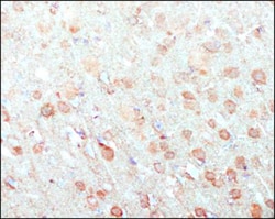 EAAT2/GLT1 Antibody - Azide Free, Novus Biologicals 0.1mL; Unlabeled:Antibodies,