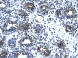 EAAT2/GLT1 Antibody, Novus Biologicals 0.05mg; Unlabeled:Antibodies, Polyclonal