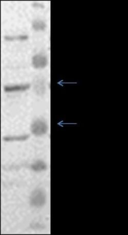 EAAT2/GLT1 Antibody, Novus Biologicals 0.05mg; Unlabeled:Antibodies, Polyclonal