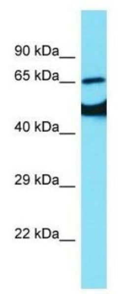 EAAT2/GLT1 Antibody, Novus Biologicals 0.05mg; Unlabeled:Antibodies, Polyclonal