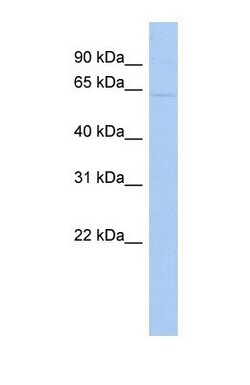 EAAT2/GLT1 Antibody, Novus Biologicals 0.05mg; Unlabeled:Antibodies, Polyclonal