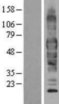 Novus Biologicals&trade;&nbsp;EAAT3 Overexpression Lysate