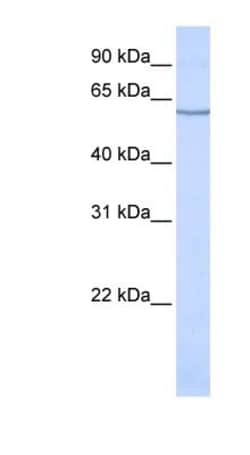EAAT3 Antibody, Novus Biologicals 20&mu;L; Unlabeled:Antibodies, Polyclonal