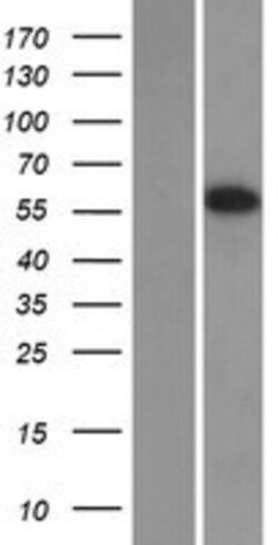 Novus Biologicals&trade;&nbsp;EAAT4 Overexpression Lysate