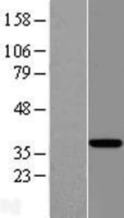 Novus Biologicals&trade;&nbsp;EAF2 Overexpression Lysate