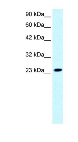 Eaf6 Antibody, Novus Biologicals 100 &mu;L | Buy Online | Novus Biologicals | Fisher Scientific
