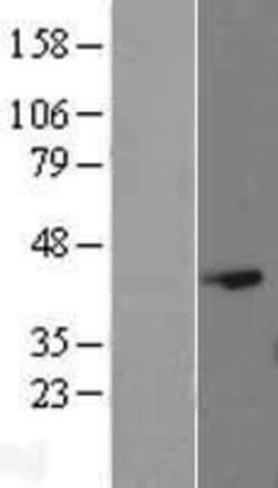 Novus Biologicals&trade;&nbsp;EAPP Overexpression Lysate