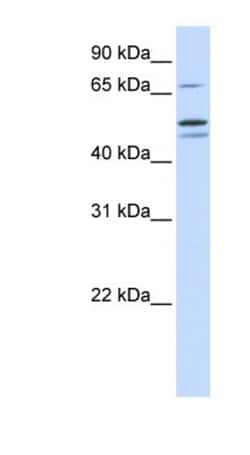 EARS2 Antibody, Novus Biologicals 20&mu;L; Unlabeled:Antibodies, Polyclonal