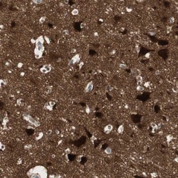 EB3 Antibody, Novus Biologicals:Antibodies:Primary Antibodies