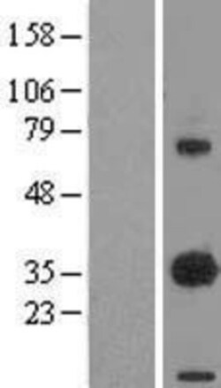 Novus Biologicals&trade;&nbsp;EBAG9/RCAS1 Overexpression Lysate
