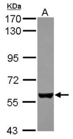 EBF-3 Antibody, Novus Biologicals 0.1mL; Unlabeled:Antibodies, Polyclonal