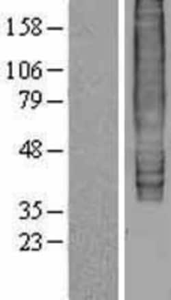 Novus Biologicals&trade;&nbsp;EBI2/GPR183 Overexpression Lysate