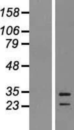 Novus Biologicals&trade;&nbsp;EBI3 Overexpression Lysate