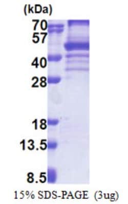 Novus Biologicals&trade;&nbsp;Recombinant Human EBNA1BP2 His Protein