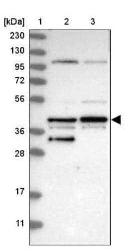 EBNA1BP2 Antibody, Novus Biologicals:Antibodies:Primary Antibodies