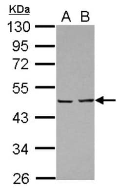 PA2G4/EBP1 Antibody, Novus Biologicals 0.1mL; Unlabeled:Antibodies, Polyclonal