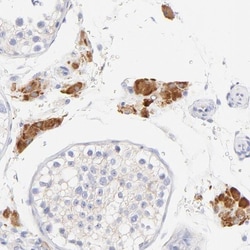 EBP Antibody, Novus Biologicals:Antibodies:Primary Antibodies