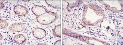 E-Cadherin Antibody (7H12), Novus Biologicals:Antibodies:Primary Antibodies