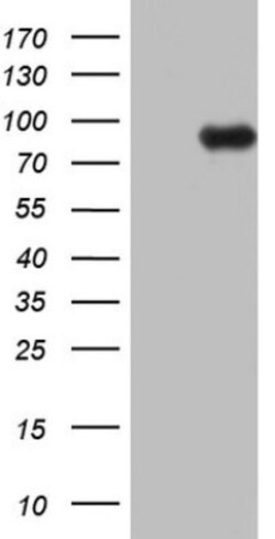 ECE-1 Antibody (OTI2B6), Novus Biologicals 0.1mL; Unlabeled:Antibodies,