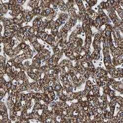 ECH1 Antibody, Novus Biologicals 0.1mL; Unlabeled:Antibodies, Polyclonal