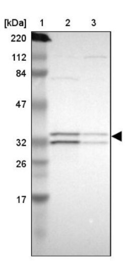 ECH1 Antibody, Novus Biologicals 0.1mL; Unlabeled:Antibodies, Polyclonal