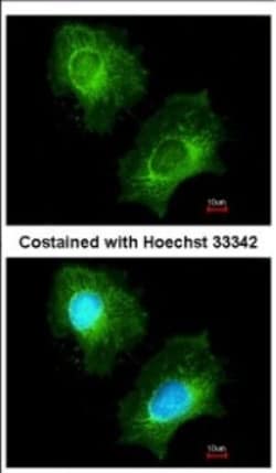 ECHS1 Antibody, Novus Biologicals 0.1mL; Unlabeled:Antibodies, Polyclonal
