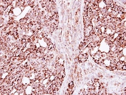 ECHS1 Antibody, Novus Biologicals 0.1mL; Unlabeled:Antibodies, Polyclonal