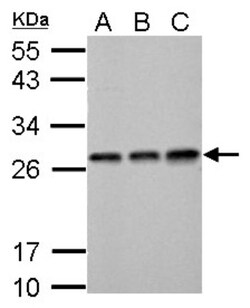 ECHS1 Antibody, Novus Biologicals 0.1mL; Unlabeled:Antibodies, Polyclonal