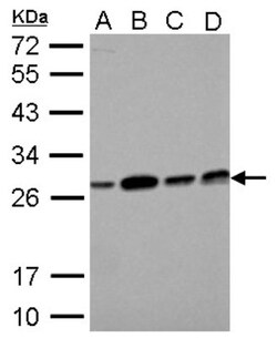 ECHS1 Antibody, Novus Biologicals 0.1mL; Unlabeled:Antibodies, Polyclonal