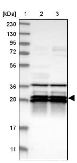 ECHS1 Antibody, Novus Biologicals 25 &mu;L | Buy Online | Novus Biologicals | Fisher Scientific