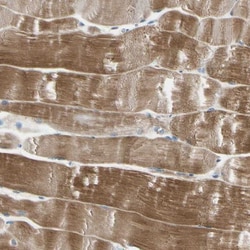 ECRG4 Antibody, Novus Biologicals 0.1mL; Unlabeled:Antibodies, Polyclonal