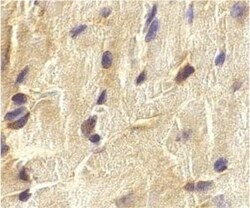 ECSIT Antibody, Novus Biologicals 0.1mg; Unlabeled:Antibodies, Polyclonal