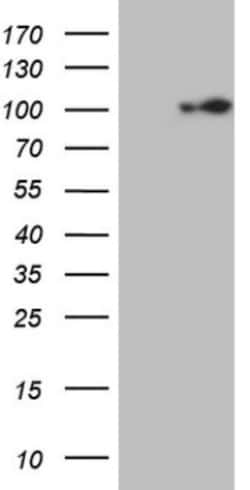 ECT2 Antibody (OTI2D9), Novus Biologicals 0.1mL; Unlabeled:Antibodies,