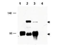 TORC1 Antibody, Novus Biologicals 0.1mg; Unlabeled:Antibodies, Polyclonal