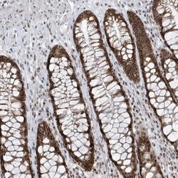 ECT2L Antibody, Novus Biologicals:Antibodies:Primary Antibodies